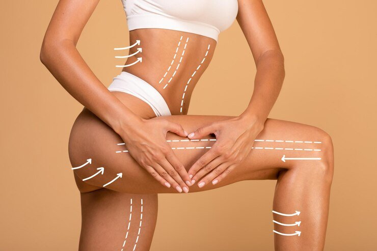 lifting-antiage-concept-young-woman-with-massage-lines-arrows-her-body-touching-skin-leg_116547-36043