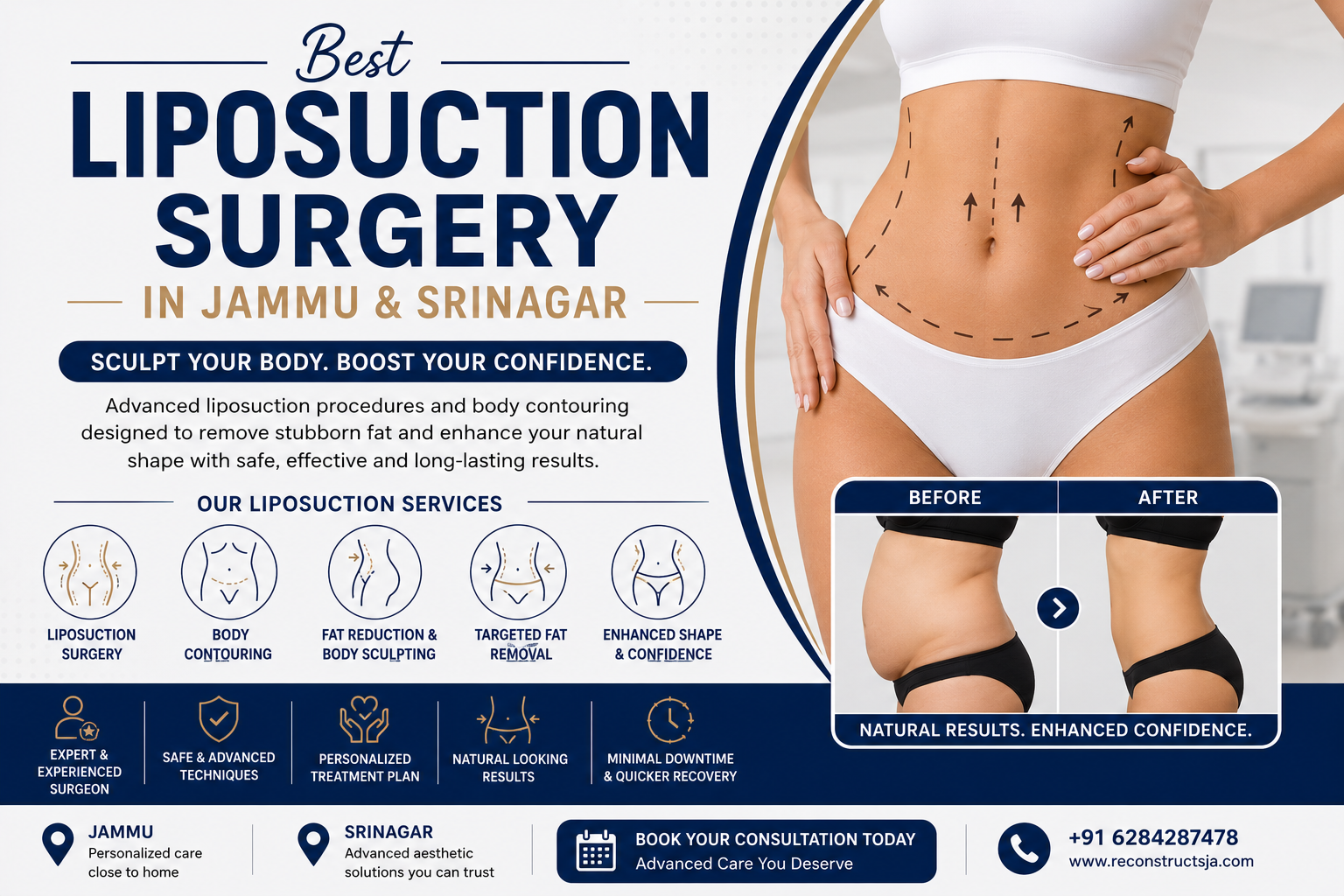 liposuction surgery in jammu