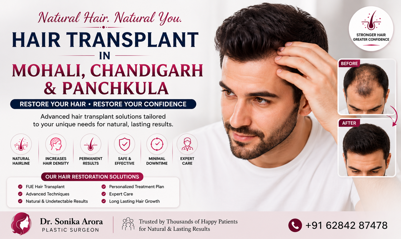 hair transplant in mohali