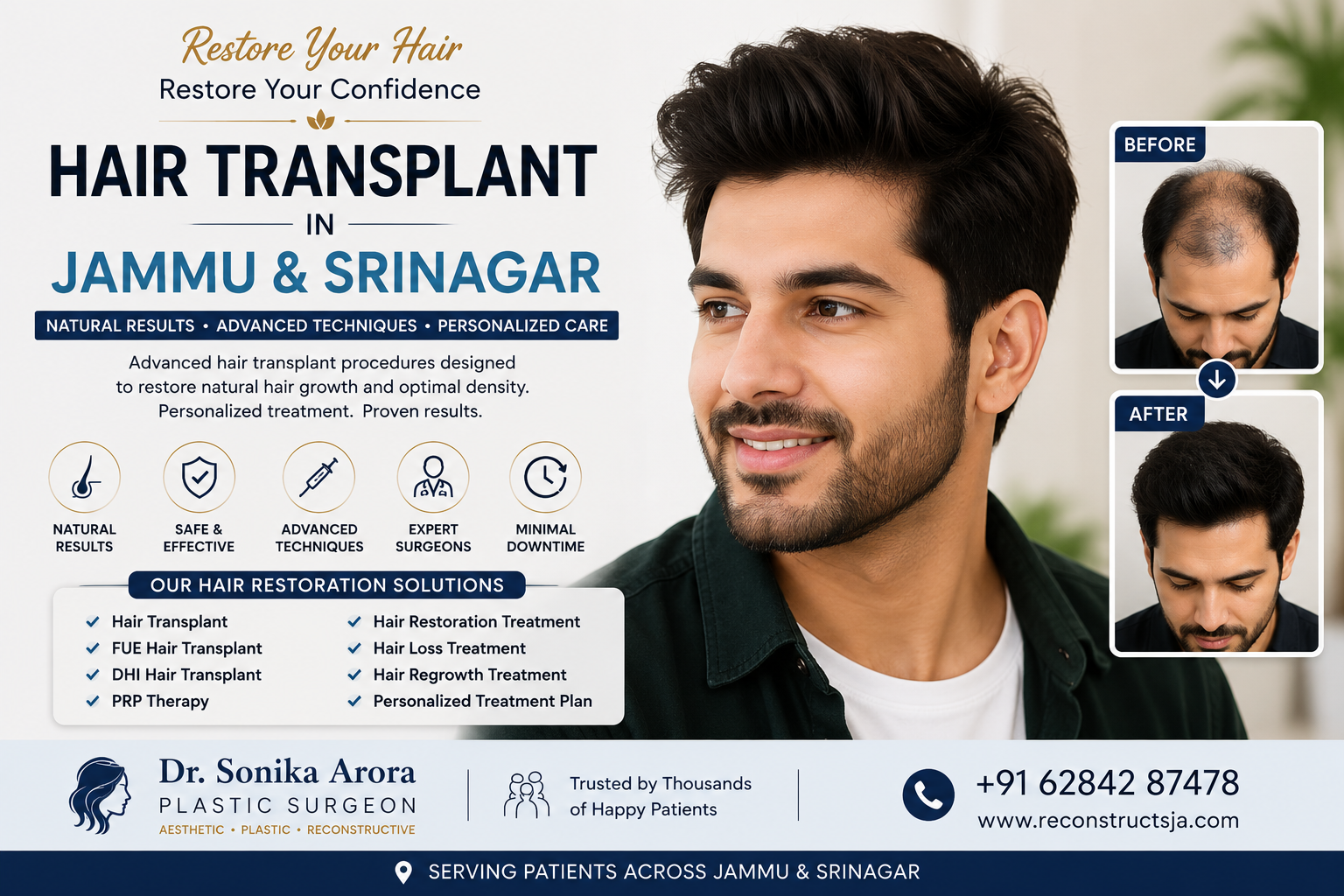 Best Hair Transplant in Jammu