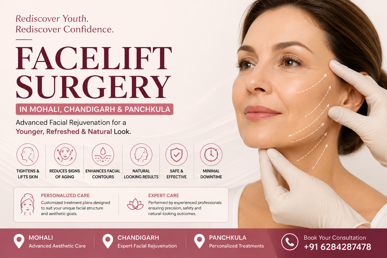 facelift surgery in mohali